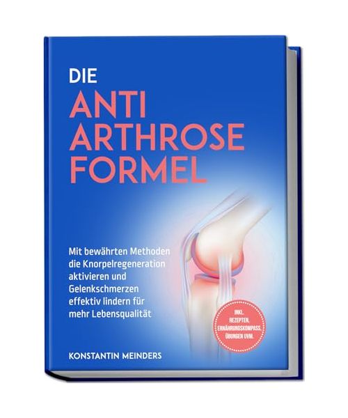 Die Anti Arthrose Formel: Mit bewährten Methoden die Knorpelregeneration aktivieren und Gelenkschmerzen effektiv lindern für mehr Lebensqualität - inkl. Rezepten, Ernährungskompass, Übungen uvm.