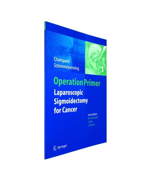 Laparoscopic Sigmoidectomy for Cancer
