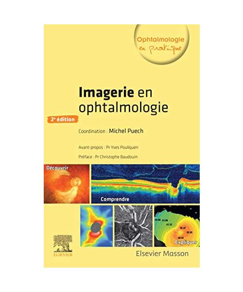 Imagerie en ophtalmologie
