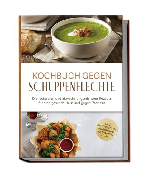 Kochbuch gegen Schuppenpflechte: Die leckersten und abwechslungsreichsten Rezepte für eine gesunde Haut und gegen Psoriasis - inkl. Brotrezepten, Fingerfood, Getränken u.v.m.