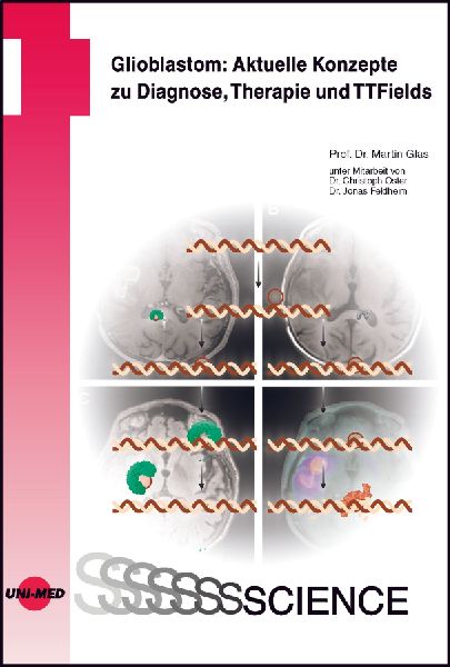 Glioblastom: Aktuelle Konzepte zu Diagnose, Therapie und TTFields