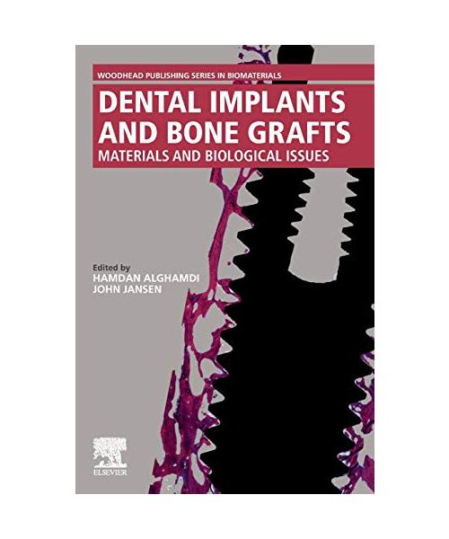 Dental Implants and Bone Grafts