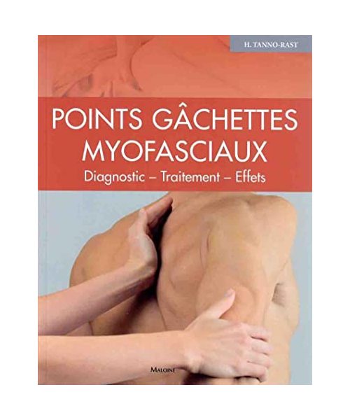 Points gâchettes Myofasciaux: Diagnostic ? traitement ? effets