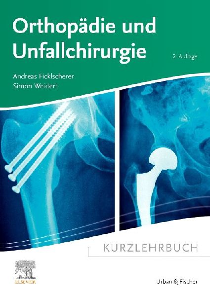 Kurzlehrbuch Orthopädie und Unfallchirurgie