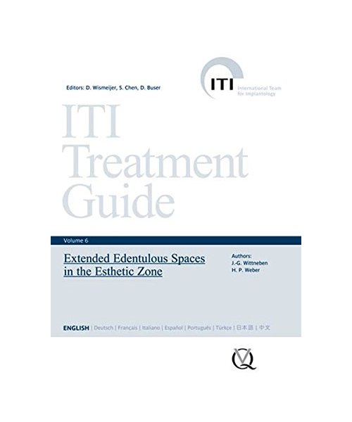 Extended Edentulous Spaces in the Esthetic Zone