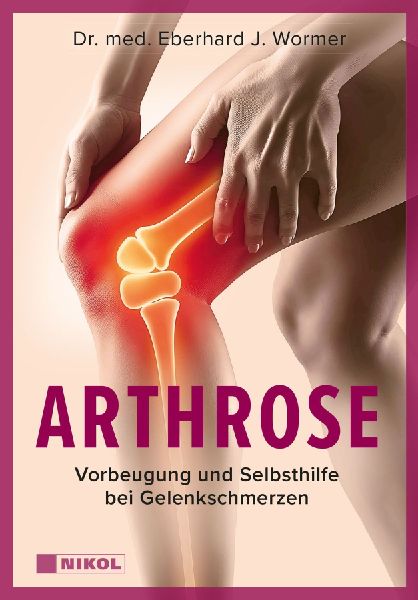 Arthrose: Vorbeugung und Selbsthilfe bei Gelenkschmerzen