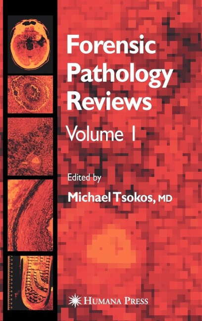 Forensic Pathology Reviews