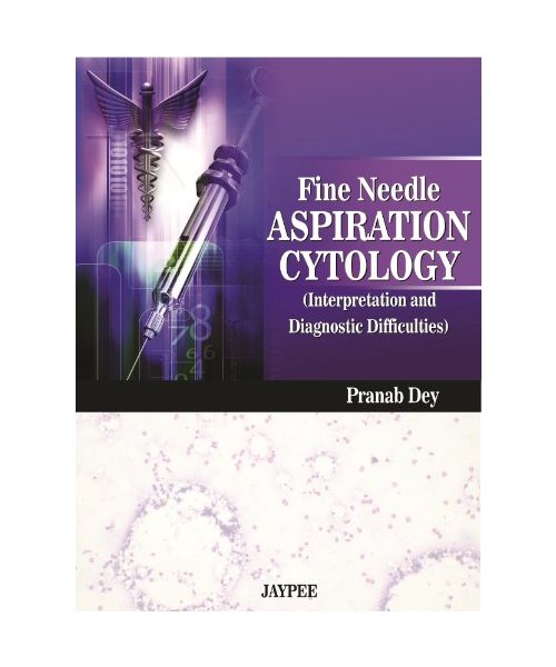 Fine Needle Aspiration Cytology Interpretation and Diagnostic Difficulties