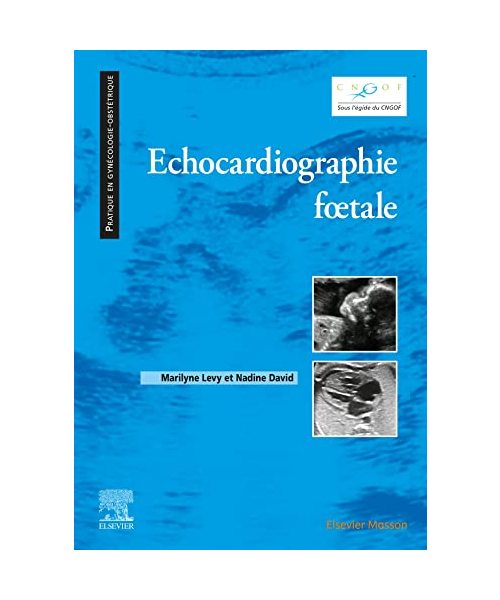 Echocardiographie Fotale