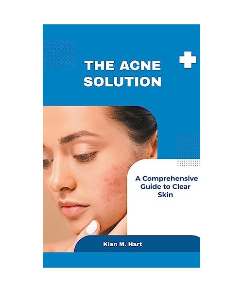 The Acne Solution