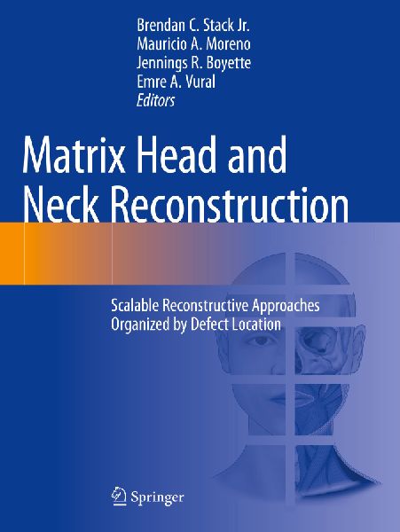 Matrix Head and Neck Reconstruction