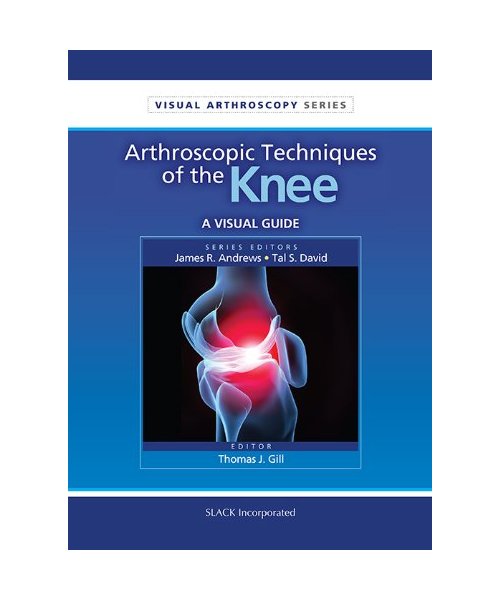 Arthroscpic Techniques of the Knee: A Visual Guide