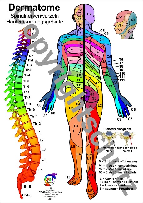 Dermatome - Spinalnervenwurzeln Hautversorgungsgebiete: Übersichtskarte A5 (Lehrtafeln: Übersichtskarten)