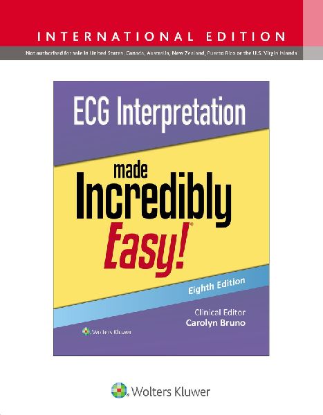 ECG Interpretation Made Incredibly Easy!