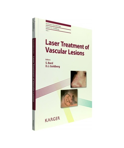 Laser Treatment of Vascular Lesions