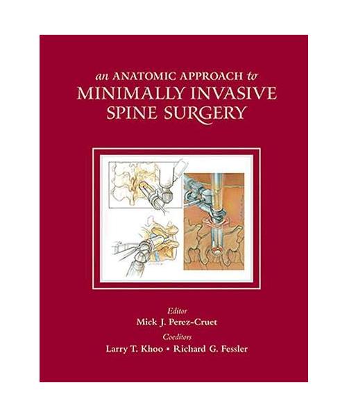 ANATOMIC APPROACH TO MINIMALLY