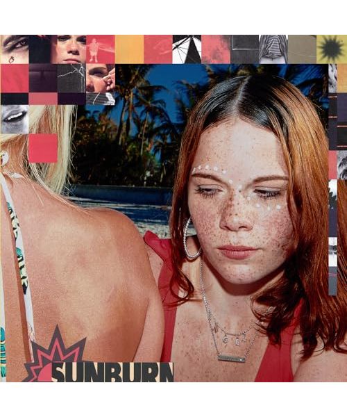 Sunburn