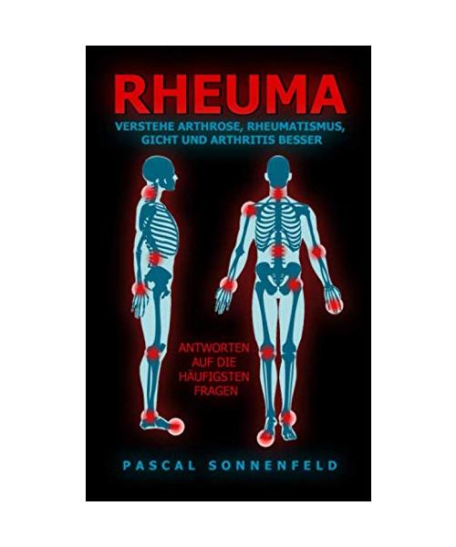 Rheuma: Verstehe Arthrose, Rheumatismus, Gicht und Arthritis besser: Antworten auf die häufigsten Fragen